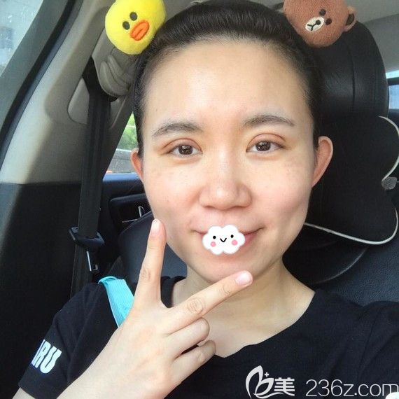 <!--<i data=20240703-sp></i>-->皮秒激光去斑術(shù)后真實(shí)恢復(fù)效果