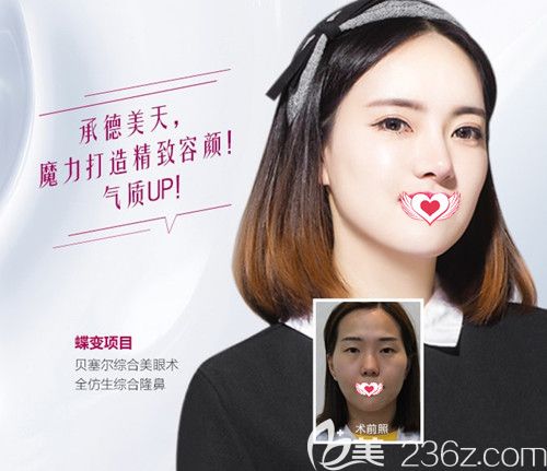 美天整形醫(yī)院做鼻綜合案例 美天整形醫(yī)院做鼻綜合案例