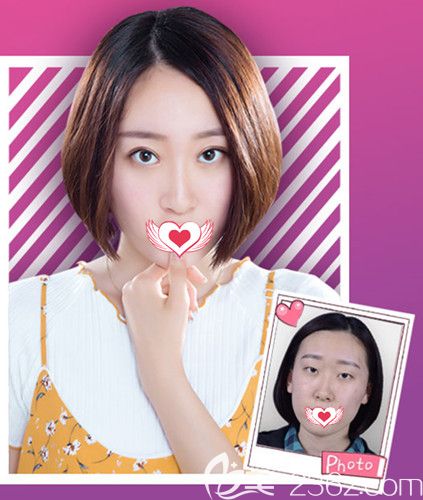 承德美天3月送出大量整形福利禮包 雙眼皮和隆鼻價(jià)格優(yōu)惠為1500元