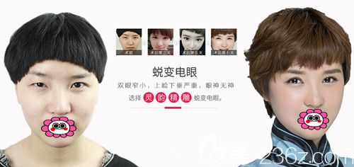 愛(ài)思特黃祥石雙眼皮效果圖