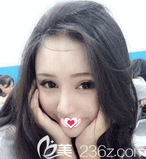 這次在邢臺遇見美做的眼鼻綜合手術 給我的感受就是整形前后對比效果反差挺大