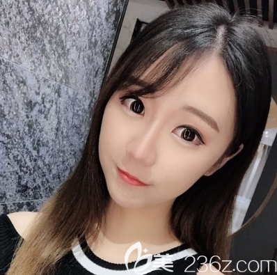 因?yàn)榕绿鬯哉曳鹕郊邀愓斡诹⒚襻t(yī)生做的鼻綜合隆鼻的時(shí)候我選擇了全麻