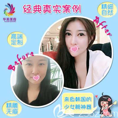 3月女人節(jié)邯鄲華美推出一大波整形優(yōu)惠活動 雙眼皮專享價為1680元