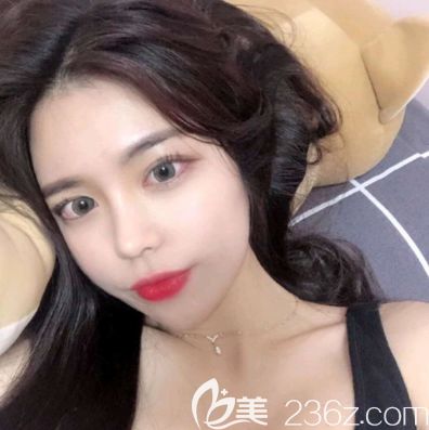 廣州紫馨李政祐做隆鼻子怎么樣 廣州紫馨李政祐做隆鼻子怎么樣