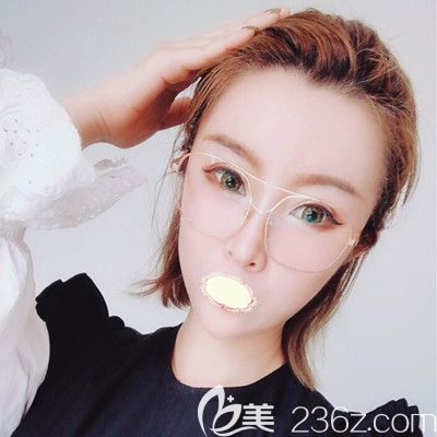 哈爾濱臻美<!--<i data=20240703-sp></i>-->面部自體脂肪填充術(shù)后18天效果圖 哈爾濱臻美<!--<i data=20240703-sp></i>-->面部自體脂肪填充術(shù)后18天效果圖