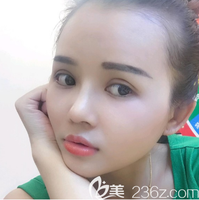 廣州美恩許揚濱做雙眼皮隆鼻子怎么樣 廣州美恩許揚濱做雙眼皮隆鼻子怎么樣