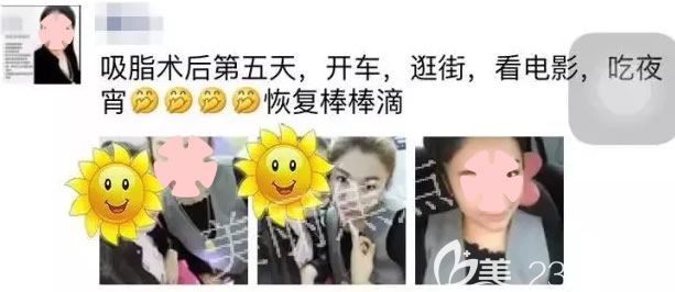 我在南寧美麗焦點(diǎn)做水動(dòng)力腰腹吸脂第5天恢復(fù)情況 我在南寧美麗焦點(diǎn)做水動(dòng)力腰腹吸脂第5天恢復(fù)情況