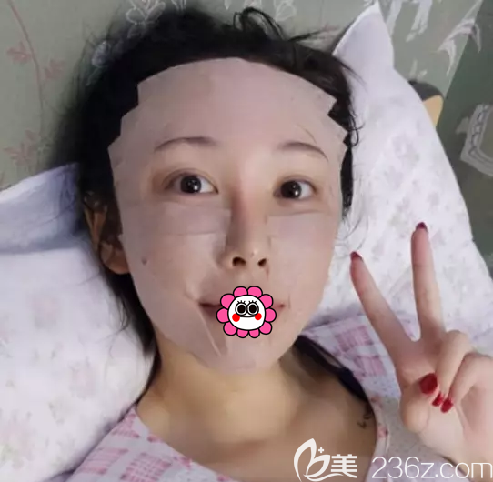 自體脂肪面部填充即刻 自體脂肪面部填充即刻