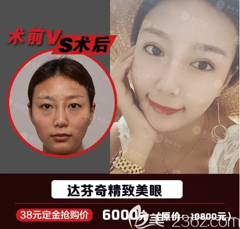 重慶華美雙眼皮怎么樣