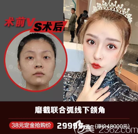 重慶華美磨骨技術(shù)怎么樣