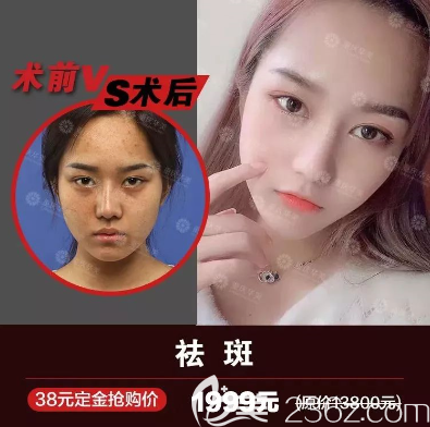 重慶華美祛斑怎么樣？