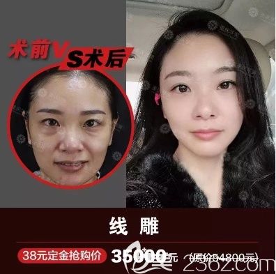 重慶華美線雕多少錢？