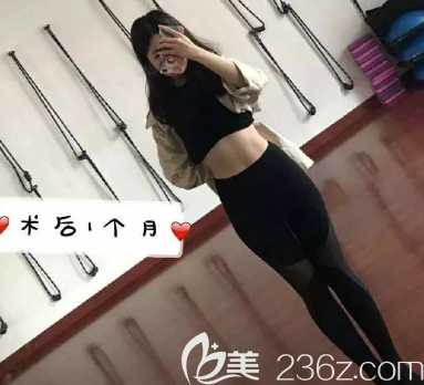 水動(dòng)力吸脂術(shù)后一個(gè)月的照片