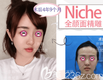 北京京韓整形醫(yī)院價(jià)格表 面部脂肪填充單部位低至6240元，手臂吸脂低至17280元