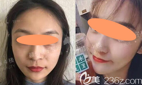 暗訪贛州葉子整形怎么樣?公布醫(yī)院收費(fèi)價(jià)格表及真人實(shí)例成效前后對比照