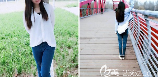 <!--<i data=20240703-sp></i>-->大腿吸脂一個(gè)月恢復(fù)情況 <!--<i data=20240703-sp></i>-->大腿吸脂一個(gè)月恢復(fù)情況