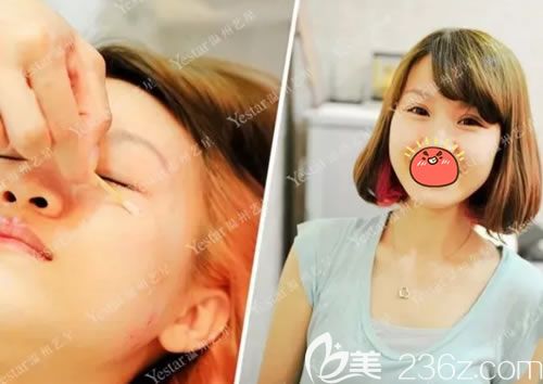 溫州藝星注射<span style= 溫州藝星注射<span style=