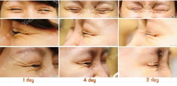 溫州藝星注射<span style= 溫州藝星注射<span style=