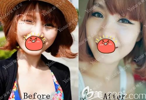 溫州藝星注射<span style= 溫州藝星注射<span style=