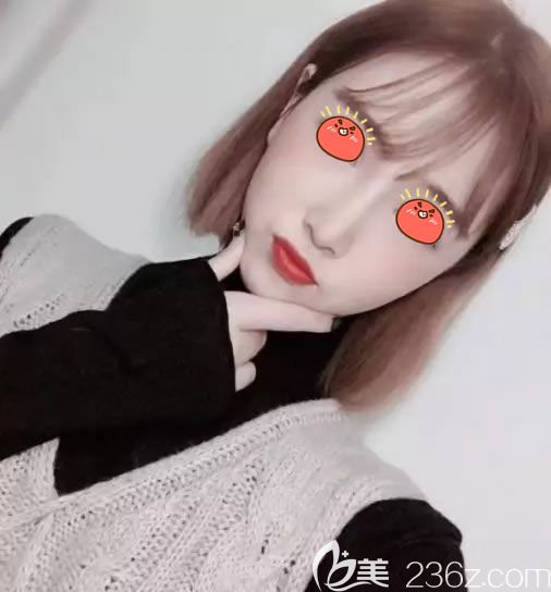 義烏陽光整形醫(yī)院隆鼻隆下巴<span style= 義烏陽光整形醫(yī)院隆鼻隆下巴<span style=