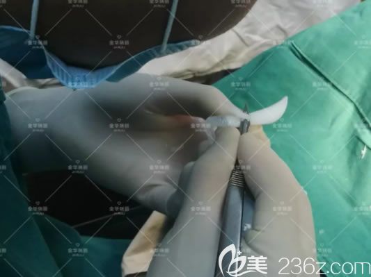 金華瑞麗劉政假體隆鼻手術(shù)過程 金華瑞麗劉政假體隆鼻手術(shù)過程