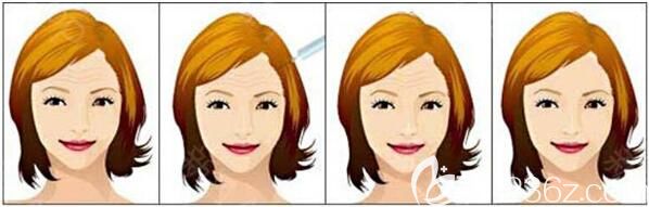 上海伯思立醫(yī)療美容門診部瘦臉除皺除皺<span style= 上海伯思立醫(yī)療美容門診部瘦臉除皺除皺<span style=