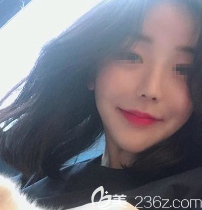 韓國(guó)玉芭做了隆鼻修復(fù)手術(shù)后2周