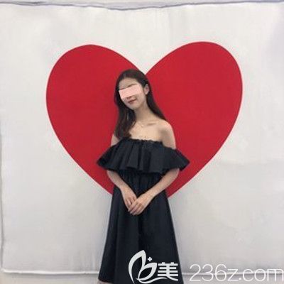 假體隆下巴第1個月 假體隆下巴第1個月