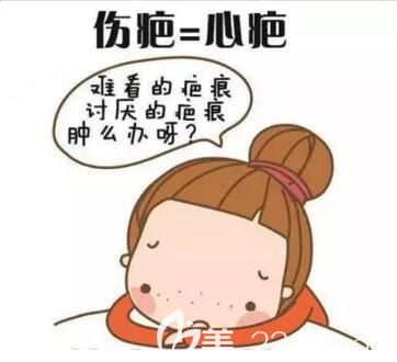 疤痕的存在對(duì)個(gè)人的影響很大