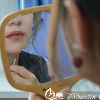 西寧康華<!--<i data=20240703-sp></i>-->院長(zhǎng)為我注射隆下巴術(shù)后當(dāng)天照