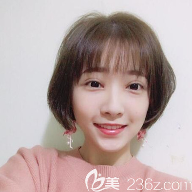 鄧東偉切開雙眼皮術(shù)后一個月恢復(fù)照