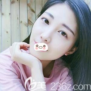 洛陽華美自體脂肪填充術(shù)后7i天 洛陽華美自體脂肪填充術(shù)后7i天