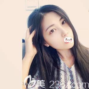 洛陽華美自體脂肪填充術(shù)后15天 洛陽華美自體脂肪填充術(shù)后15天