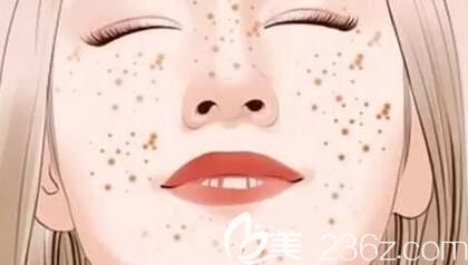 臉上色斑的形成原因