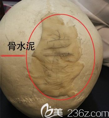 韓國(guó)ITEM愛(ài)婷填充后腦勺使用材料