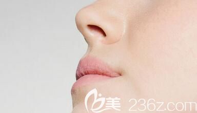 自體肋軟骨隆鼻多久恢復(fù)？