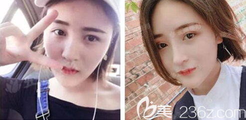 重慶五洲整形隆鼻怎么樣？