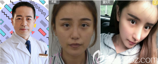 王俊河醫(yī)生和他的自體脂肪填充案例