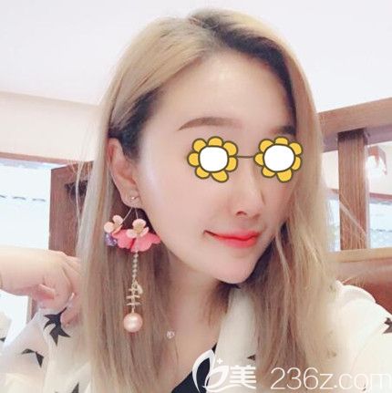 三個(gè)月前在錦州斯美諾做了全臉線雕提升效果挺好的，跟大家分享一下恢復(fù)效果圖！