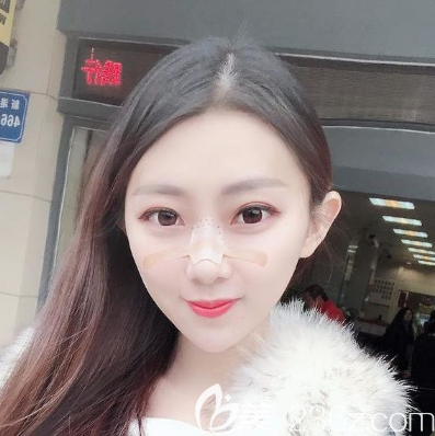 做完鼻綜合隆鼻五天不能碰水 做完鼻綜合隆鼻五天不能碰水