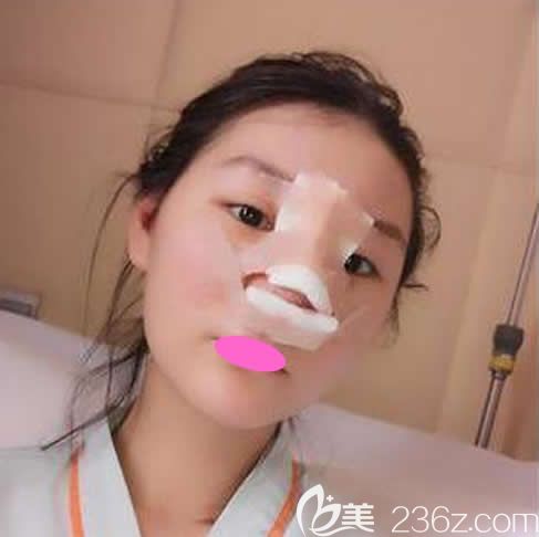 去贛州亞韓整形醫(yī)院做鼻綜合手術(shù)第1天照 去贛州亞韓整形醫(yī)院做鼻綜合手術(shù)第1天照