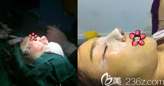 金華亞美鄧澤臣鼻修復(fù)和雙眼皮<span style= 金華亞美鄧澤臣鼻修復(fù)和雙眼皮<span style=