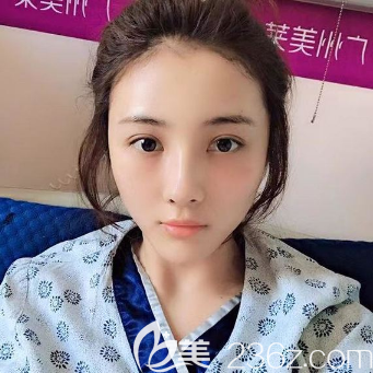 廣州美萊<!--<i data=20240703-sp></i>-->自體脂肪全臉填充 廣州美萊<!--<i data=20240703-sp></i>-->自體脂肪全臉填充