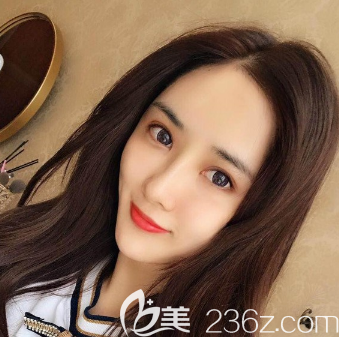 <!--<i data=20240703-sp></i>-->面部脂肪填充全臉一個月恢復(fù)自然 <!--<i data=20240703-sp></i>-->面部脂肪填充全臉一個月恢復(fù)自然