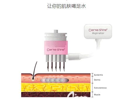 常州施爾美分享原理