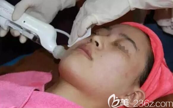 常州施爾美醫(yī)生注射過(guò)程中