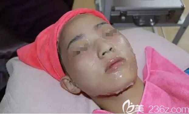 注射完以后要敷醫(yī)用面膜緩解