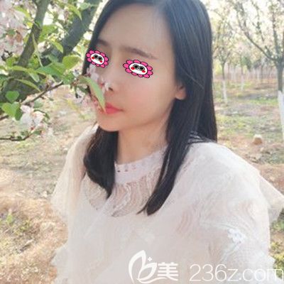 術(shù)后一個(gè)月效果展示圖 術(shù)后一個(gè)月效果展示圖