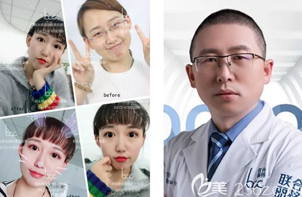 <!--<i data=20240703-sp></i>-->整形醫(yī)院董曉宏醫(yī)生割雙眼皮、開(kāi)眼角、光子嫩膚除皺效果怎么樣