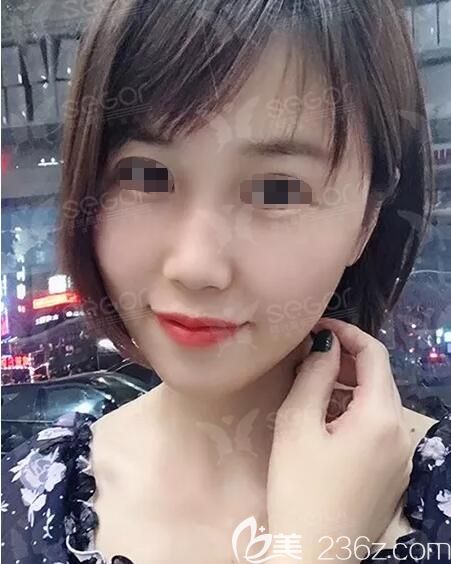 常州曙光分享納米脂肪全面部<span style= 常州曙光分享納米脂肪全面部<span style=